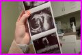 Counting On Alum Joy-Anna Forsyth Updates At 33 Weeks Pregnant